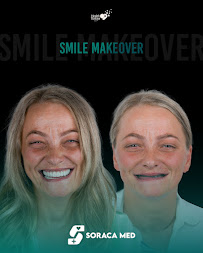 Soraca Med | Dental Treatment, Plastic Surgery and Hair Transplant