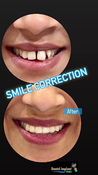 Dr.Sudhakar Reddy's Dental Implant Studio