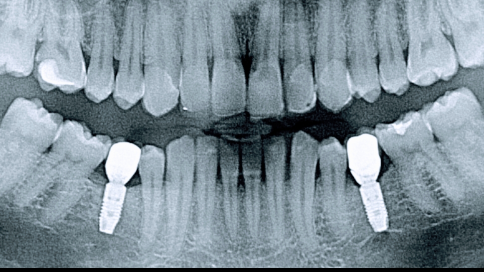 Dental Implant Centre dental clinic