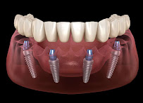 Dental Implant Centre