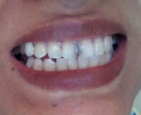 32 Smiles