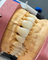 ASPEN DENTAL CARE | DENTAL CLINIC BANGALORE