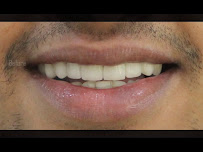 All Smiles Dental- cosmetic dentistry