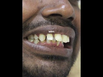 All Smiles Dental- cosmetic dentistry