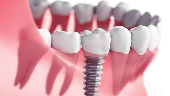 Mico Dental Clinic dental clinic