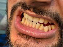 Mico Dental Clinic (A multi speciality dental, implant , Invisalign ® provider ,RCT and wisdom tooth centre )