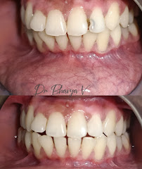 Exotic Smiles & Aesthetics - Best Dental clinic in Bangalore ,RRnagar | Dental clinic in Banagalore