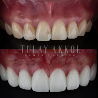 Tülay Akkol Dental Clinic
