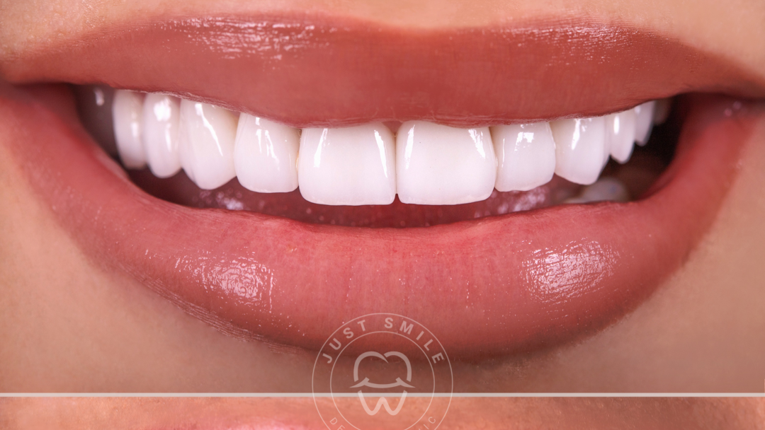 Just Smile dental clinic