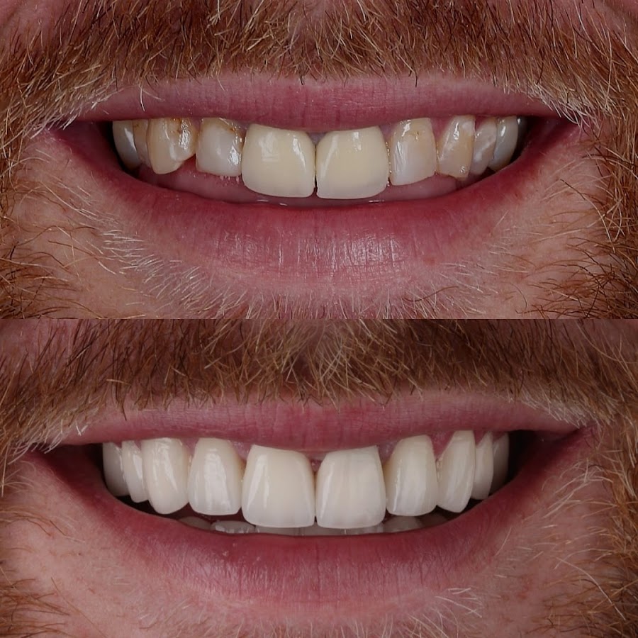 Dental Excellence Turkey dental clinic in Antalya
