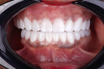 Dental Excellence Turkey
