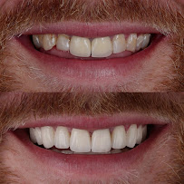 Dental Excellence Turkey in Antalya