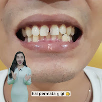 PERMATA DENTAL DOKTER GIGI Bali & ESTETIK
