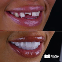 Dental Harmony Turkey