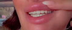 Dental Harmony Turkey