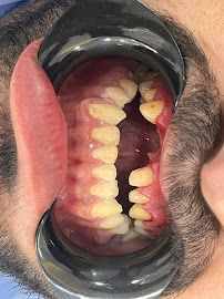 Özel Dentselfy Ağız ve Diş Sağlığı Polikliniği