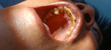 Mch siem reap dental clinic