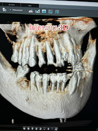 Lay Sophanna Dental Clinic ( Vuthy Seth )