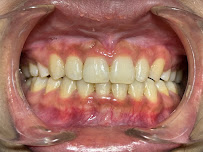 Lay Sophanna Dental Clinic ( Vuthy Seth )