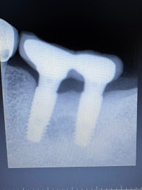 Lay Sophanna Dental Clinic ( Vuthy Seth )