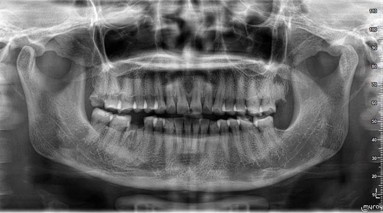 Sreng Thea dental clinic in Siem Reap