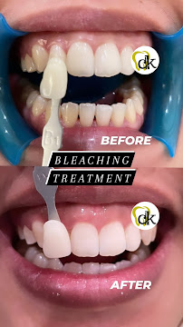 DK Dental Care Kuta in Bali