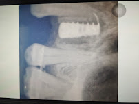 Smitha Dental, Implants & Aesthetics | Best Dentist in Jayanagar Bangalore