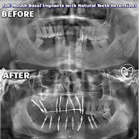 Smitha Dental, Implants & Aesthetics | Best Dentist in Jayanagar Bangalore