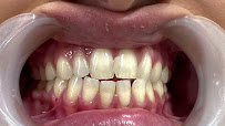 Smitha Dental, Implants & Aesthetics | Best Dentist in Jayanagar Bangalore