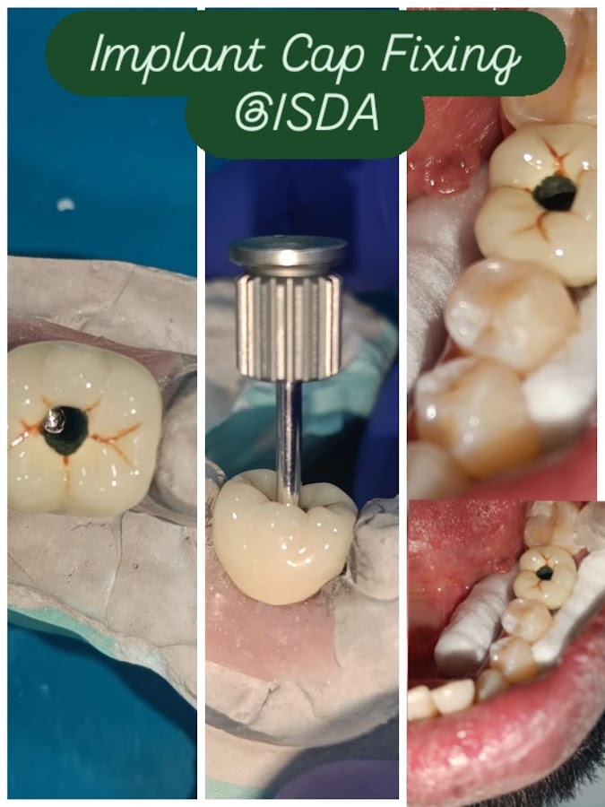 I-Smile Dental and Aesthetic Clinic dental clinic