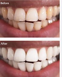 ACHALA DENTAL CLINIC / Dental clinic in Sarjapur road bangalore