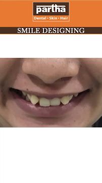 Partha Dental Clinic - Basaveshwara Nagar, Bangalore | Braces, Root Canal & Dental Implants