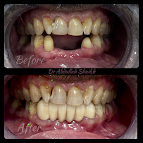 CITY DENTAL IMPLANT & AESTHETIC CLINIC | Dental Implants & Aligners in Mumbai