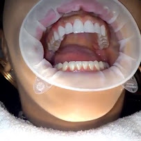 Hydro Medical Clinic Canggu - Rabies Vaccine - Bali Belly IV Drip - Dental - Dengue Recovery