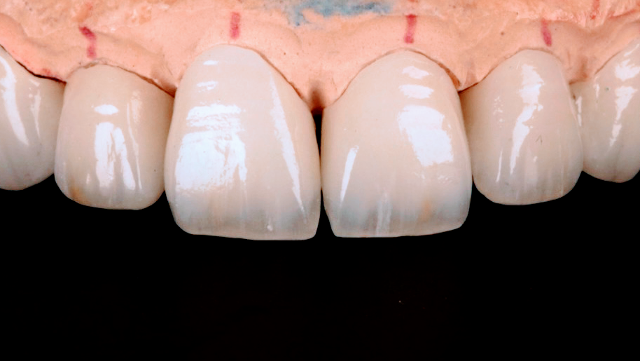 Aesthetic Smile dental clinic in Mumbai