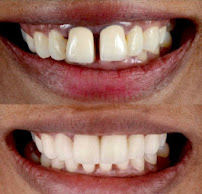 OrthoSquare Dental Clinic - Tardeo, Mumbai