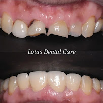 Dr. SONAL AGRAWAL - Best Dentist in Vashi, Navi Mumbai