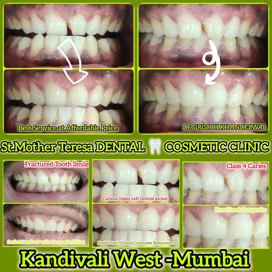 St. Mother Teresa dental clinic in Mumbai