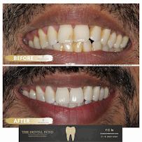 The Dental Bond