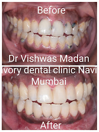 Ivory Dental Clinic ™ Seawoods