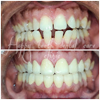 Dr.Santosh Nayak[ Happy Tooth Dental Care Clinic ]