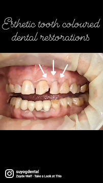 Suyog Dental Clinic and Implant Centre Mahim