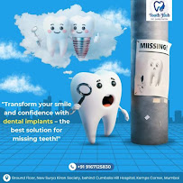 Tooth Hub Dental Clinic (Kemps Corner) | Best Dentist in South Mumbai | Ceramic Bridges | Dental Implants