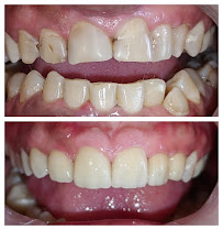 Plan Dental | Dentist and Dental Clinic in Mahim