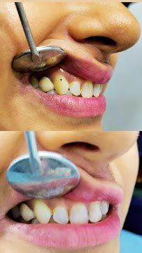 Lokare's Dental Clinic - Borivali, Mumbai