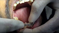 Lokare's Dental Clinic - Borivali, Mumbai