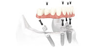 Dubrovnik Dental Clinic - DDS Pero Šutalo