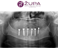 Dental Centar Župa - Dubrovnik