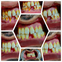 Dr Shrey Jain's Dental And Invisalign Centre @ South Mumbai