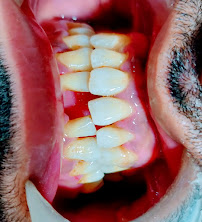 Dr Shrey Jain's Dental And Invisalign Centre @ South Mumbai
